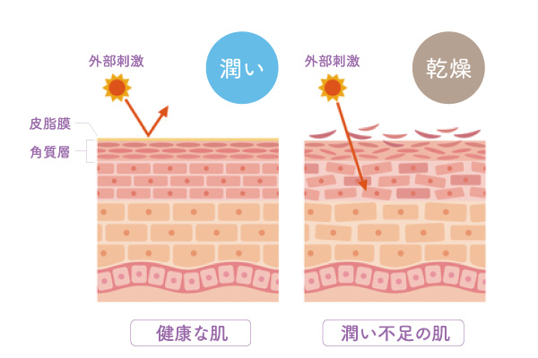 紫外線