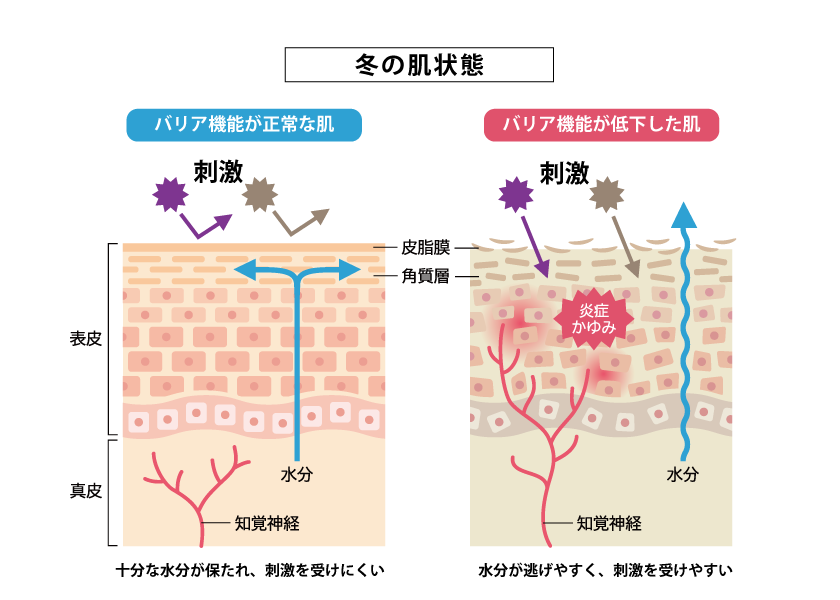 バリア機能低下